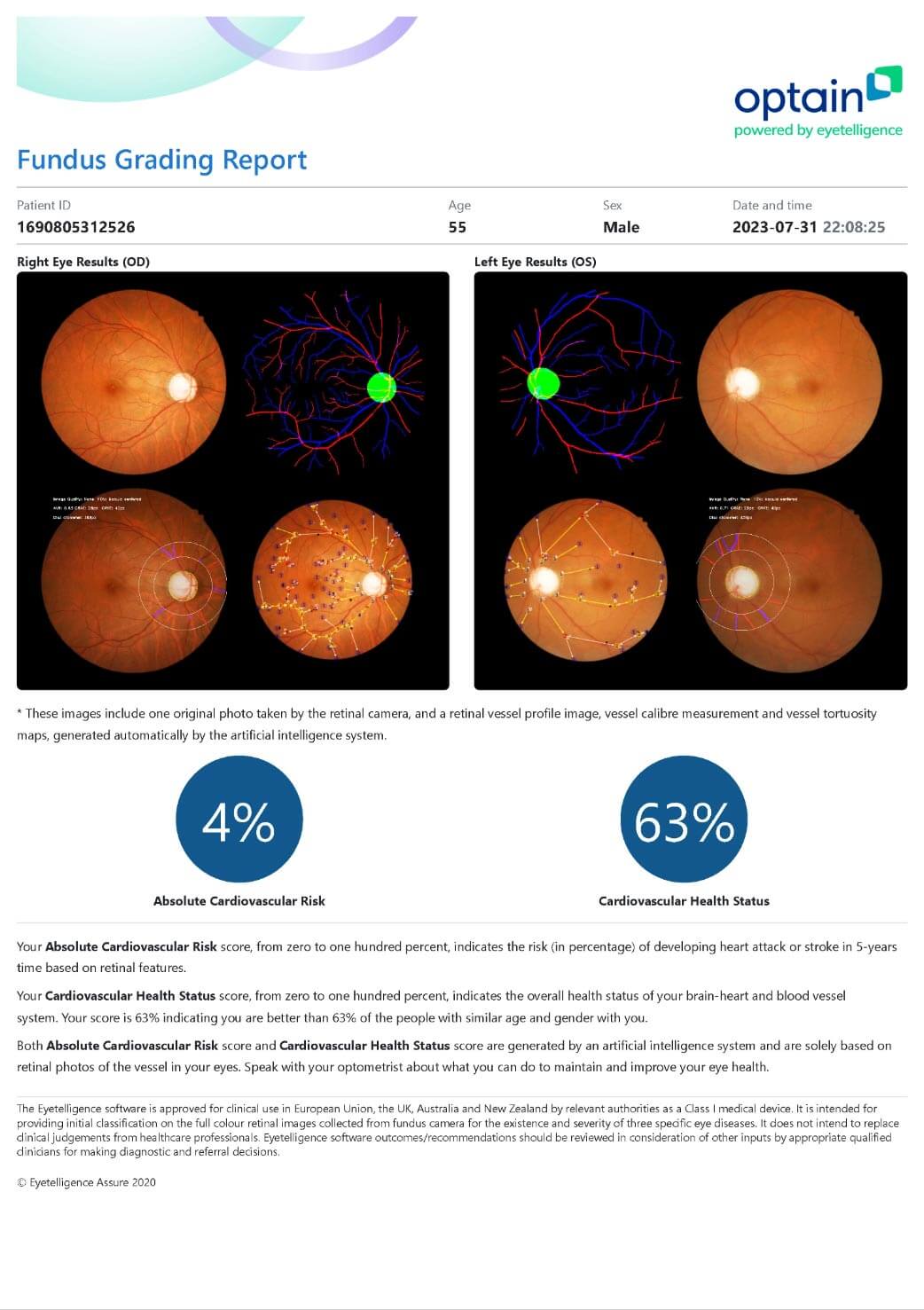 Absolute Cardiovascular Result AI Retinal Imaging Absolute Cardiovascular Result AI Retinal Imaging
